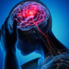 Epilepsia: la importancia de abordar los trastornos psiquiátricos y cognitivos de los pacientes