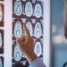 Seis recomendaciones de la neurociencia para mejorar la calidad de vida en pacientes con esclerosis múltiple